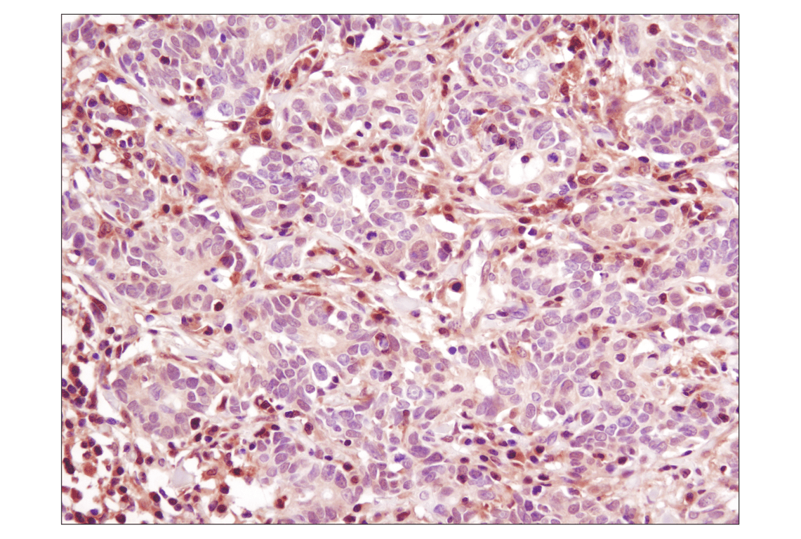 Immunohistochemistry Image 2: p38 MAPK (D13E1) XP<sup>®</sup> Rabbit mAb (BSA and Azide Free)