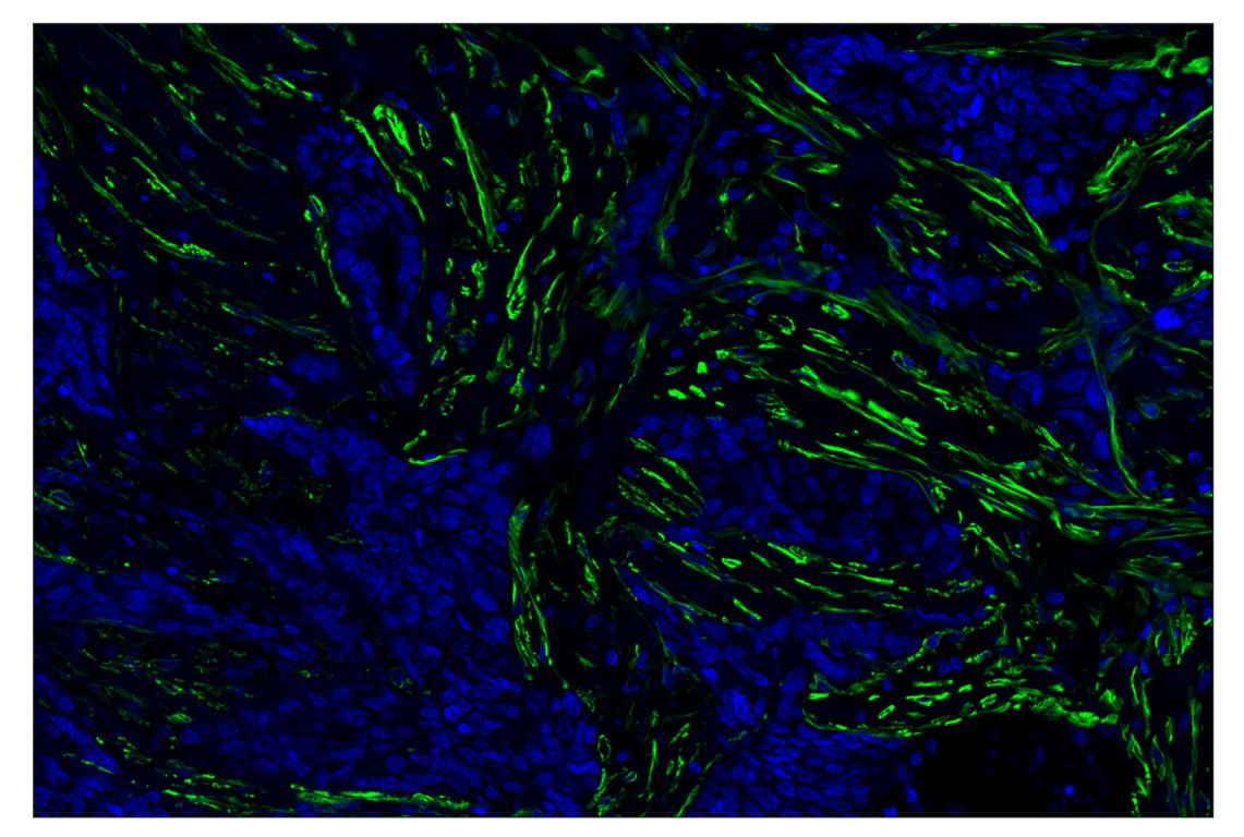 Immunohistochemistry Image 1: α-Smooth Muscle Actin (D4K9N) XP® Rabbit mAb (Alexa Fluor® 488 Conjugate)