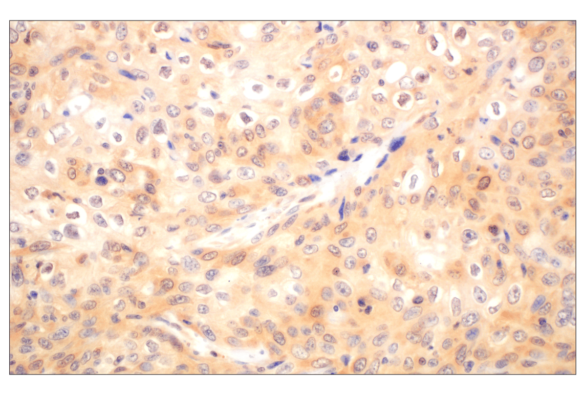 Immunohistochemistry Image 6: Galectin-8/LGALS8 (F9O3T) Rabbit mAb