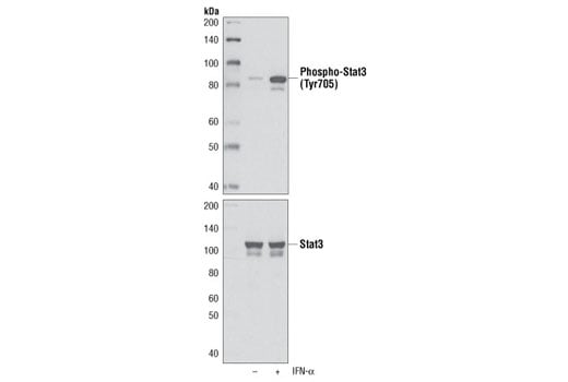 Western Blotting Image 1: Phospho-Stat3 (Tyr705) (M9C6) Mouse mAb