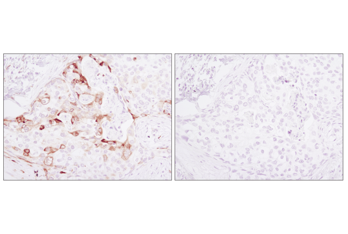 Immunohistochemistry Image 4: Phospho-S6 Ribosomal Protein (Ser235/236) (D57.2.2E) XP<sup>®</sup> Rabbit mAb (BSA and Azide Free)