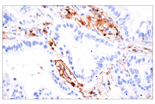 Immunohistochemistry Image 3: CD4 (EP204) Rabbit mAb