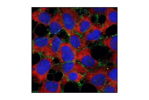 Immunofluorescence Image 1: α-N-Catenin (C12G4) Rabbit mAb