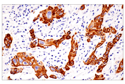 Immunohistochemistry Image 2: Pan-Keratin (5D3/LP34) Mouse mAb
