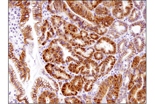 Immunohistochemistry Image 1: Non-phospho (Active) β-Catenin (Ser45) (D2U8Y) XP<sup>®</sup> Rabbit mAb (BSA and Azide Free)