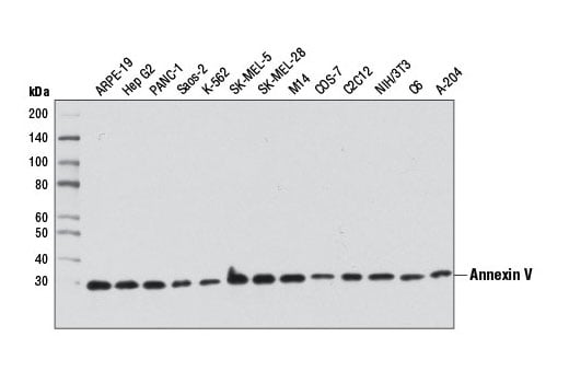 Western Blotting Image 1: Annexin V Antibody