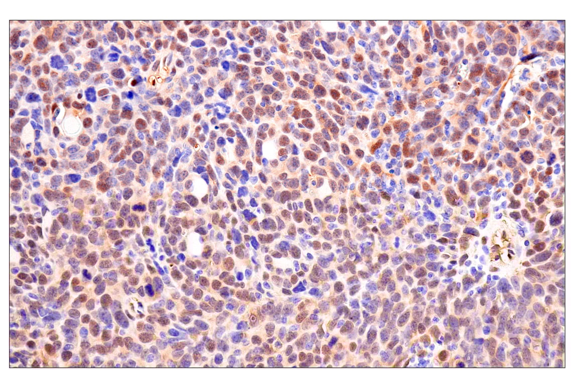 Immunohistochemistry Image 10: Phospho-YAP (Ser61) (E4Q8S) Rabbit mAb