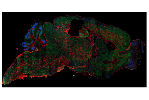 Immunofluorescence Image 1: EEA1 (C45B10) Rabbit mAb