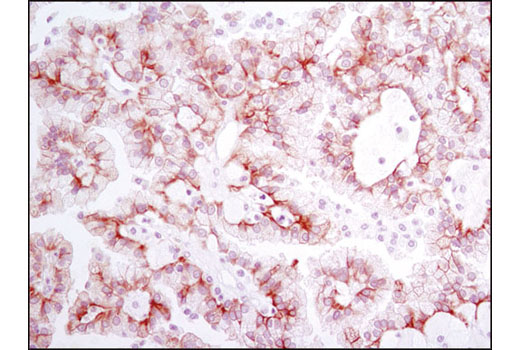 Immunohistochemistry Image 1: Met (D1C2) XP<sup>®</sup> Rabbit mAb (BSA and Azide Free)