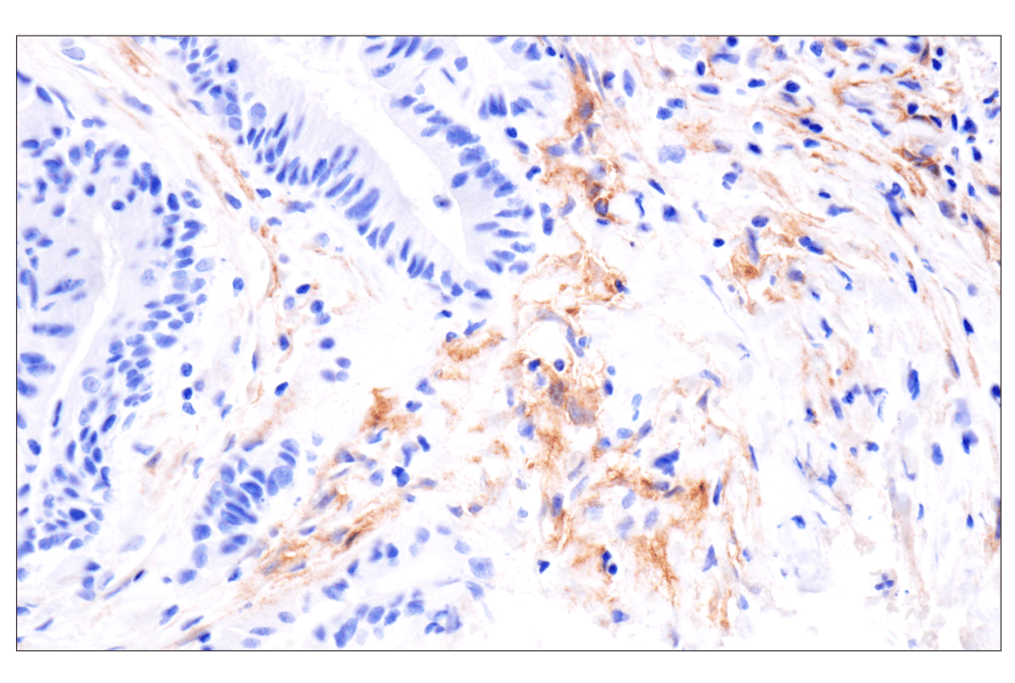 Immunohistochemistry Image 4: LRRC15 (E4X8J) Rabbit mAb