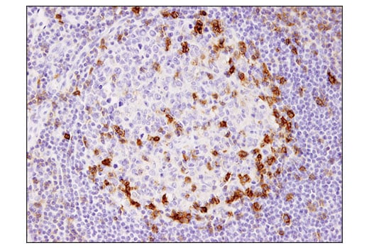 Immunohistochemistry Image 4: ICOS (D1K2T<sup>™</sup>) Rabbit mAb