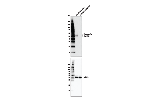 Western Blotting Image 1: Phospho-Tau (Thr181) (D9F4G) Rabbit mAb (BSA and Azide Free)