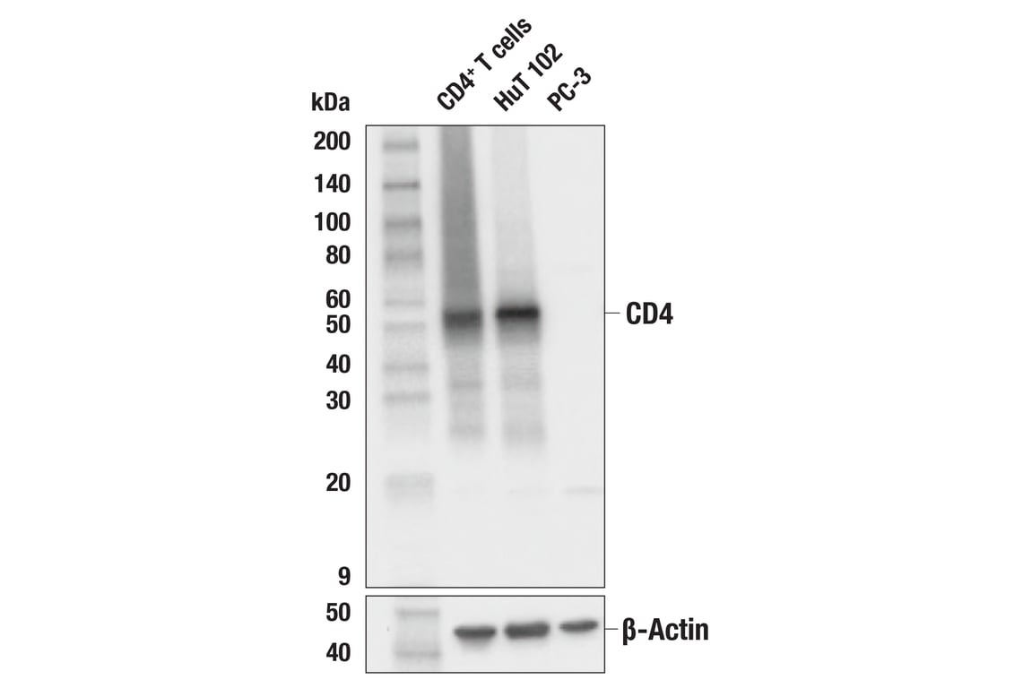 Western Blotting Image 1: CD4 (MSVA-004R) Rabbit mAb