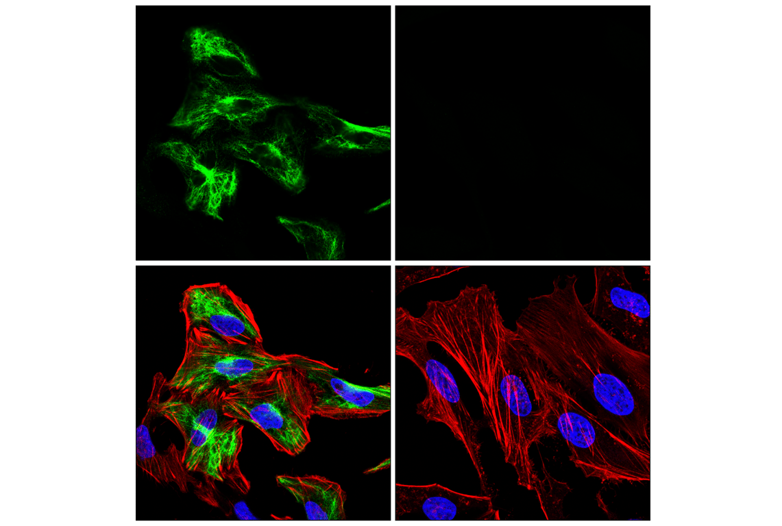 Immunofluorescence Image 1: GFAP (E6N9L) Mouse mAb