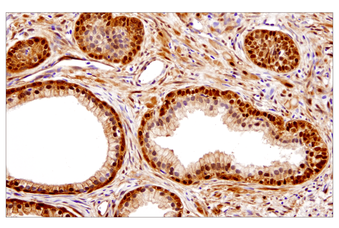 Immunohistochemistry Image 5: YAP (D8H1X) XP<sup>®</sup> Rabbit mAb