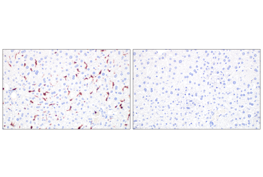 Immunohistochemistry Image 9: Integrin β2 (E9O7W) Rabbit mAb (BSA and Azide Free)