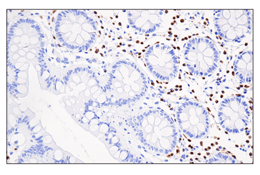 Immunohistochemistry Image 6: IRF-4 (E8H3S) XP<sup>®</sup> Rabbit mAb (BSA and Azide Free)