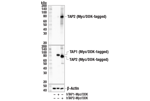 undefined Image 17: MHC Class I Antigen Processing and Presentation Antibody Sampler Kit