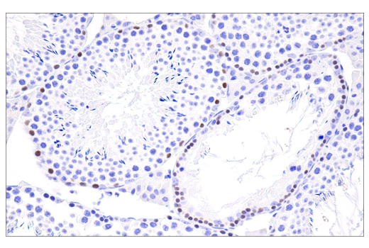 Immunohistochemistry Image 4: RUNX3/AML2 (D6E2) Rabbit mAb