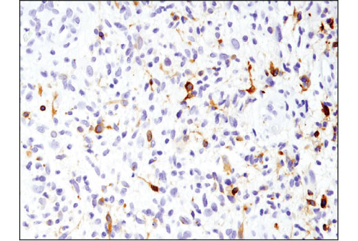 Immunohistochemistry Image 1: EGF Receptor vIII (D6T2Q) XP® Rabbit mAb (BSA and Azide Free)