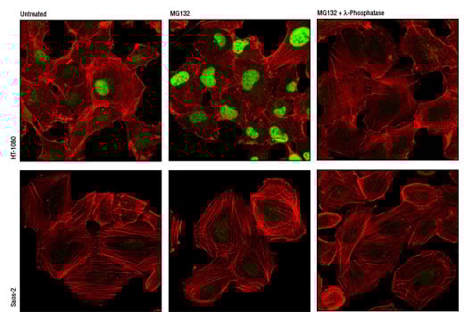 Immunofluorescence Image 1: Phospho-Cyclin D1 (Thr286) (D29B3) XP<sup>®</sup> Rabbit mAb