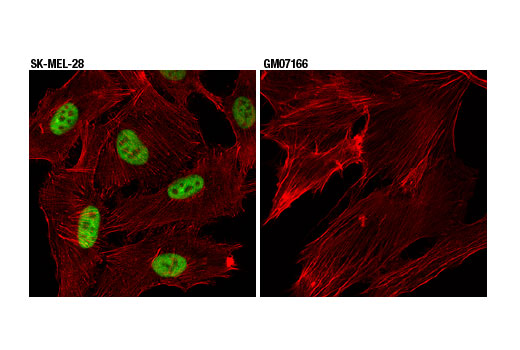 undefined Image 16: Homologous Recombination (HR) DNA Repair Antibody Sampler Kit