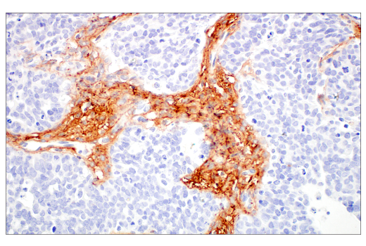 Immunohistochemistry Image 2: COL14A1 (E5W8S) Rabbit mAb (BSA and Azide Free)
