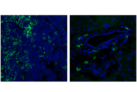 undefined Image 55: Mouse Reactive M1 vs M2 Macrophage IHC Antibody Sampler Kit