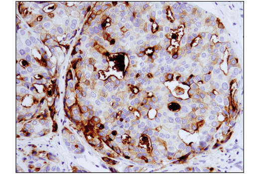 Immunohistochemistry Image 1: B7-H4 (D1M8I) XP<sup>®</sup> Rabbit mAb (BSA and Azide Free)