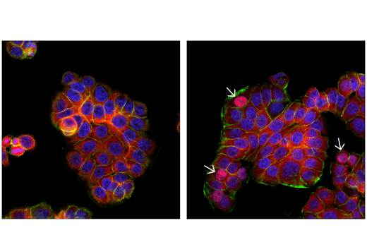 Immunofluorescence Image 1: IRF-3 (D9J5Q) Mouse mAb (Alexa Fluor<sup>®</sup> 647 Conjugate)