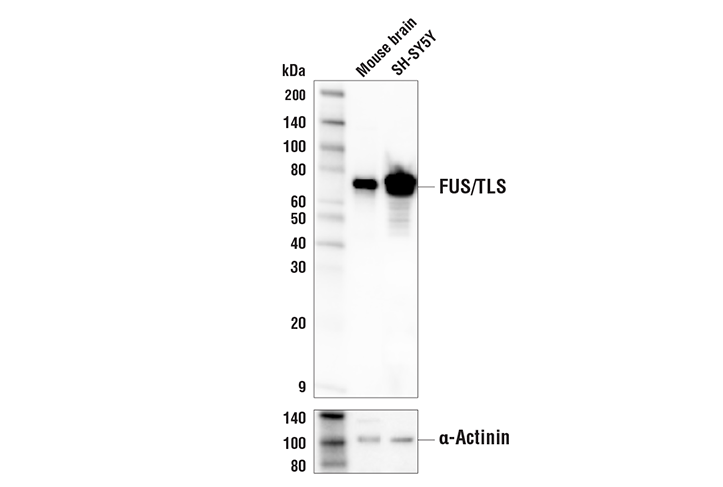 Western Blotting Image 1: FUS/TLS (E3O8I) Rabbit mAb (BSA and Azide Free)
