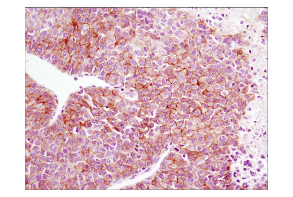undefined Image 43: Lung Cancer RTK Antibody Sampler Kit