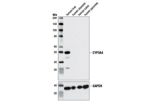 Western Blotting Image 1: CYP3A4 (D9U6N) Rabbit mAb