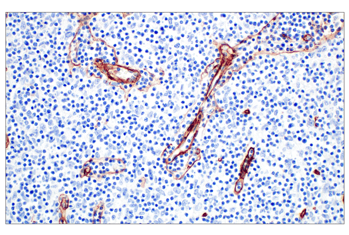Immunohistochemistry Image 4: COL4A1 (E5M6R) Rabbit mAb (IHC Formulated)