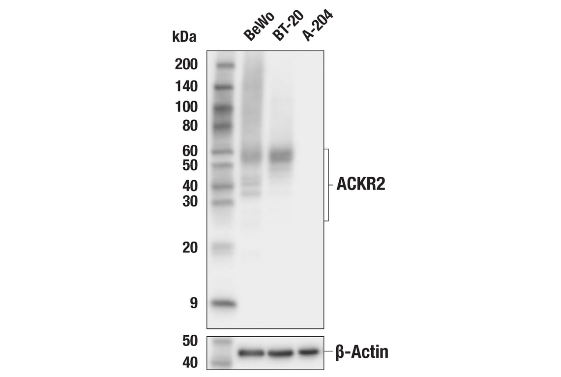 Western Blotting Image 2: ACKR2 (E9J8U) Rabbit mAb