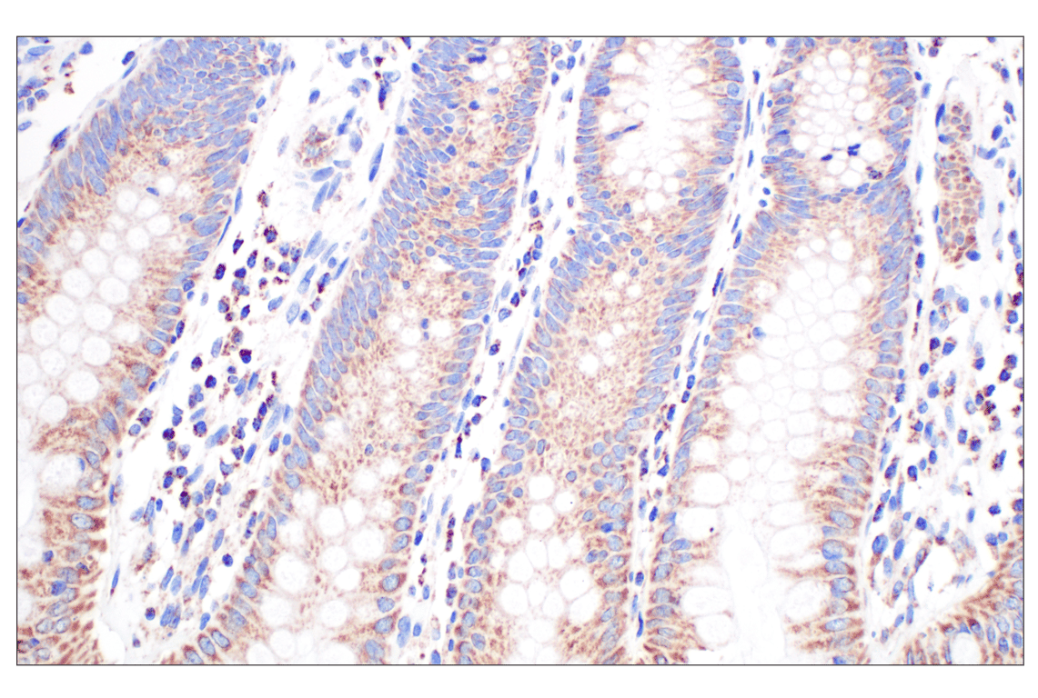 Immunohistochemistry Image 7: GCDH (F2P2M) Rabbit mAb