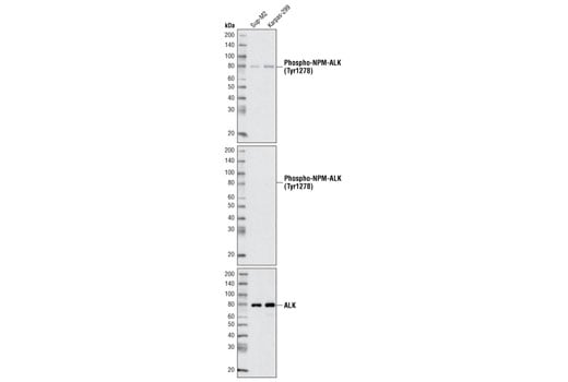 Western Blotting Image 1: Phospho-ALK (Tyr1278) Antibody