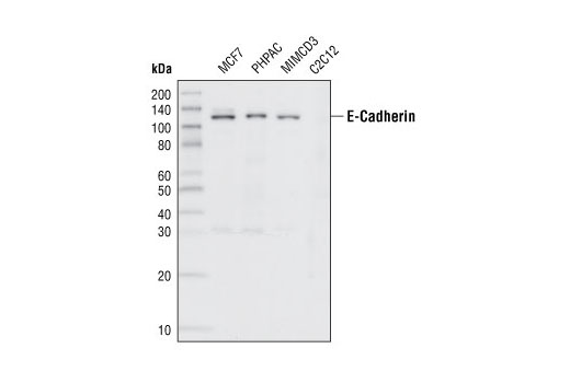 Western Blotting Image 1: E-Cadherin (24E10) Rabbit mAb (BSA and Azide Free)