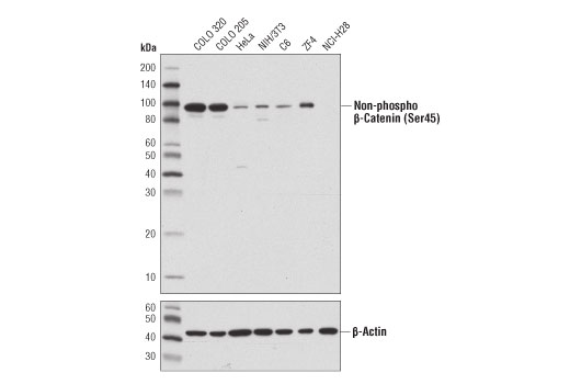 Western Blotting Image 1: Non-phospho (Active) β-Catenin (Ser45) (D2U8Y) XP<sup>®</sup> Rabbit mAb (BSA and Azide Free)