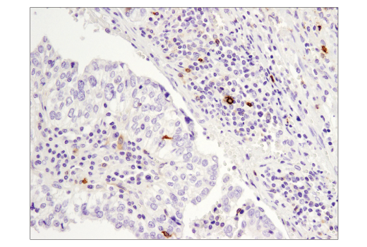 Immunohistochemistry Image 1: OX40 (E9U7O) XP<sup>®</sup> Rabbit mAb (BSA and Azide Free)