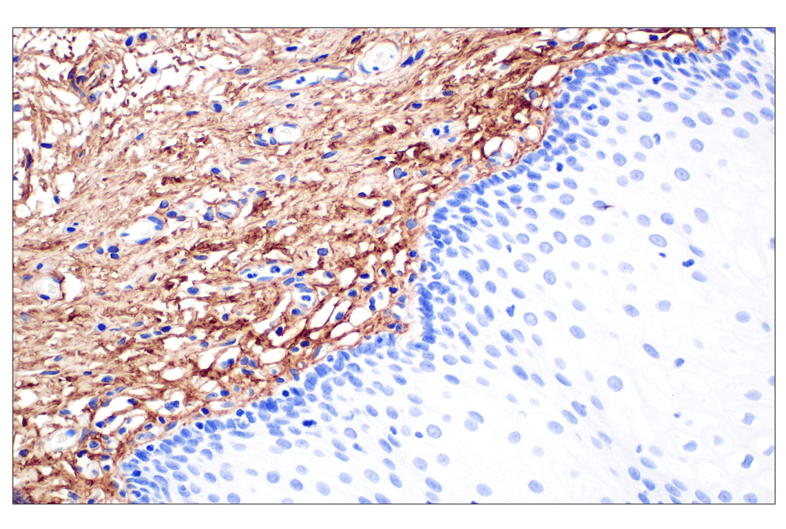 Immunohistochemistry Image 3: COL6A1 (E9U3B) Rabbit mAb (BSA and Azide Free)