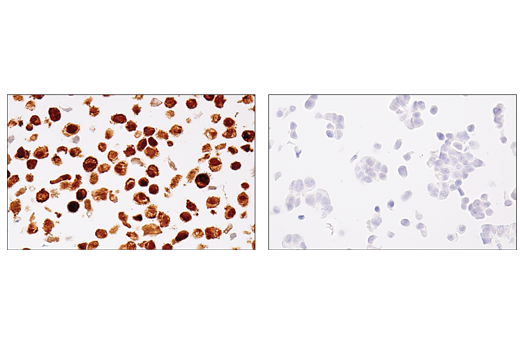 Immunohistochemistry Image 5: MAGE-A4 (E7O1U) XP<sup>®</sup> Rabbit mAb