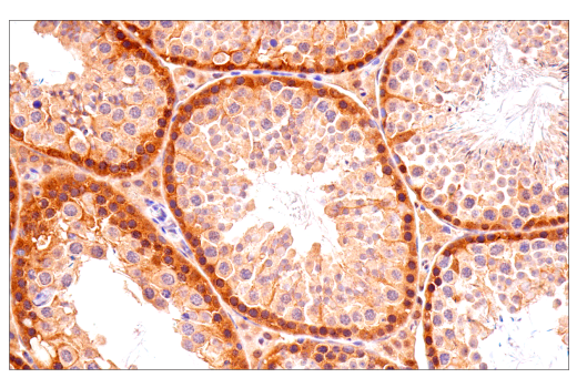 Immunohistochemistry Image 6: p70 S6 Kinase (E8K6T) XP<sup>®</sup> Rabbit mAb