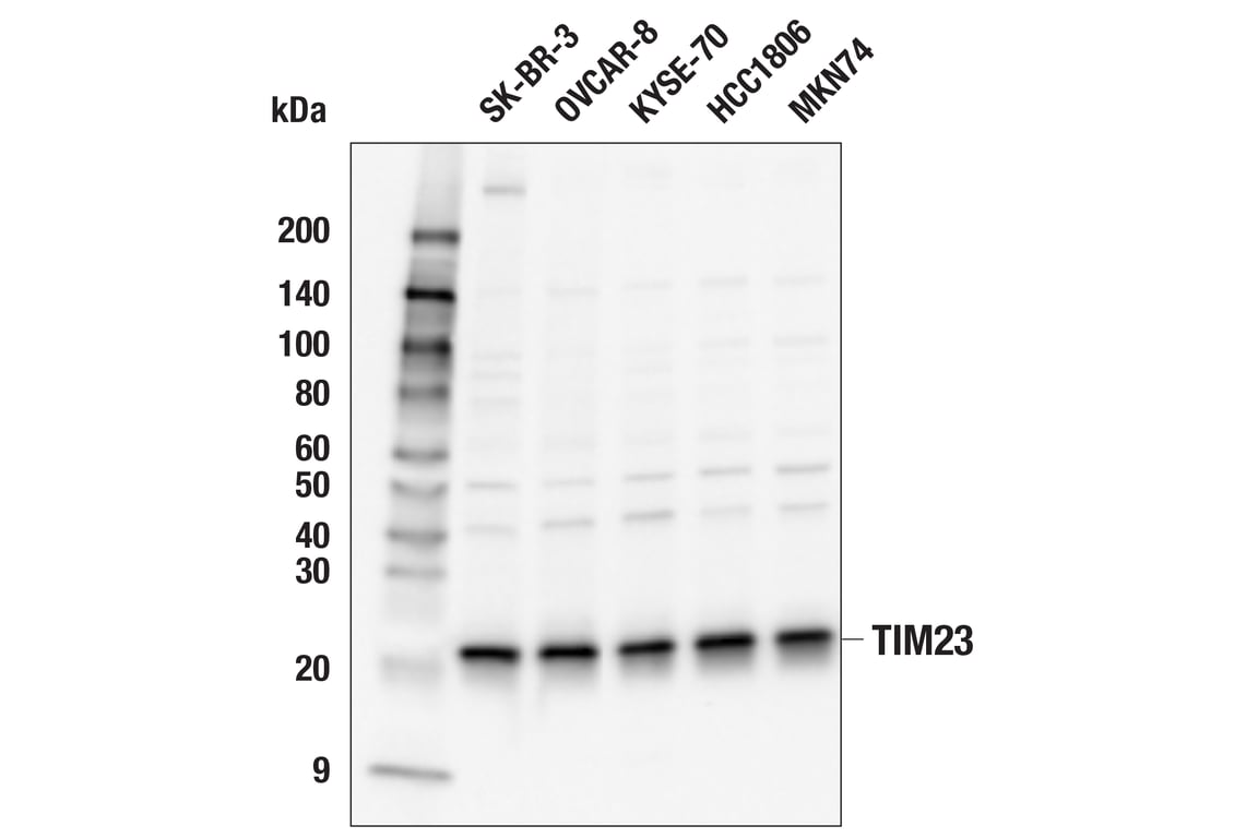 Western Blotting Image 1: TIM23 (E1Q7L) Rabbit mAb