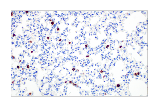undefined Image 27: Mouse Reactive M1 vs M2 Macrophage IHC Antibody Sampler Kit