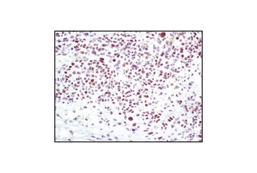 undefined Image 17: Non-Homologous End Joining (NHEJ) DNA Repair Antibody Sampler Kit