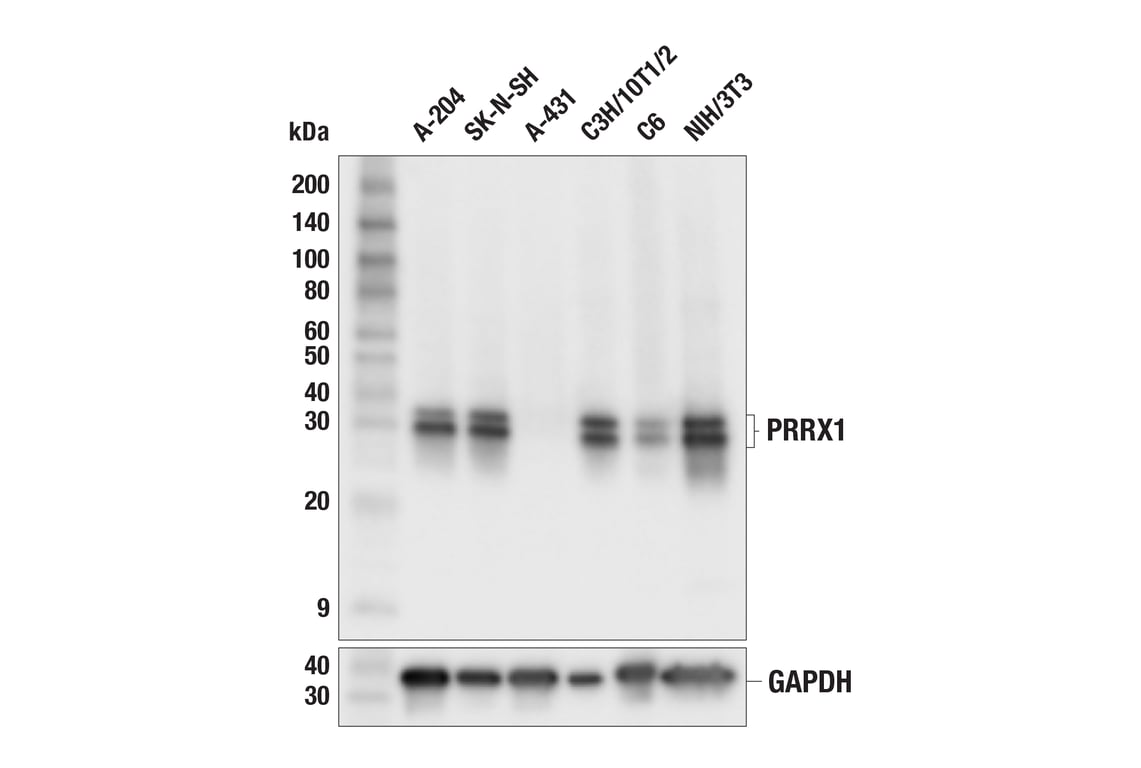 Western Blotting Image 2: PRRX1 (F3D7A) Rabbit mAb