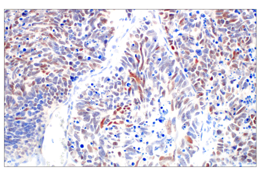 Immunohistochemistry Image 1: POU2F3 (E5N2D) XP<sup>®</sup> Rabbit mAb