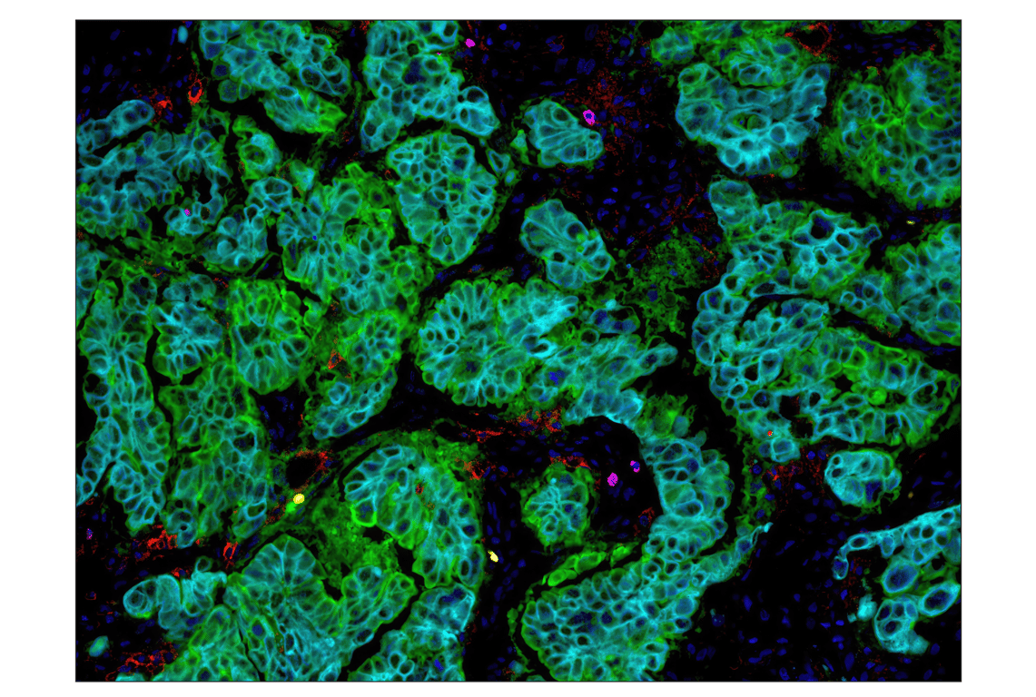 Immunohistochemistry Image 4: PD-L1 (E1L3N<sup>®</sup>) XP<sup>®</sup> Rabbit mAb