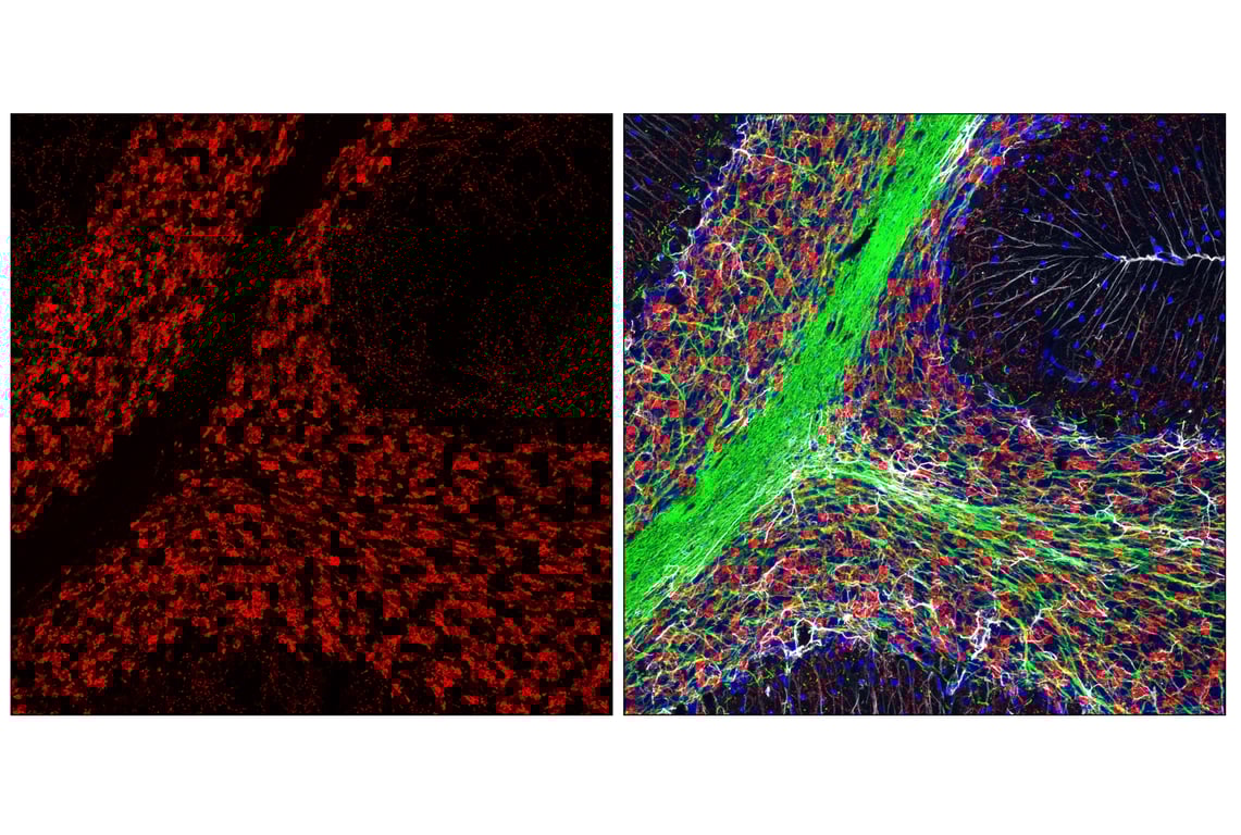 Immunofluorescence Image 2: VGLUT2 (E7P9K) Rabbit mAb